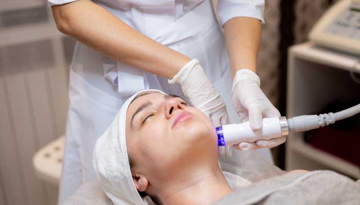 Face lifting treatment (RF)